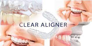 Clear Aligner Market