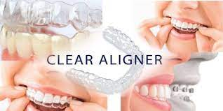 Clear Aligner Market'