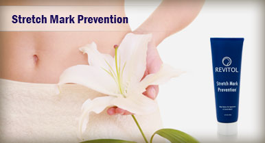 Revitol Stretch Mark Cream'