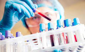 Research Antibodies and Reagents Market'