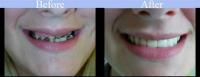 Beauty 2'