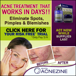 Acnezine'