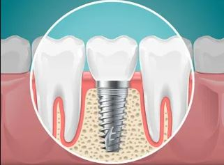 Company Logo For The Smile Institute'