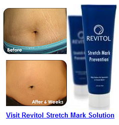 Stretch Mark Cream'