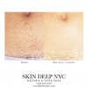 Top Rated MedSpa NYC - Skin Deep NYC Best Hair Removal'