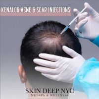 Top Rated MedSpa NYC - Skin Deep NYC Scar Injections