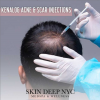 Top Rated MedSpa NYC - Skin Deep NYC Scar Injections'
