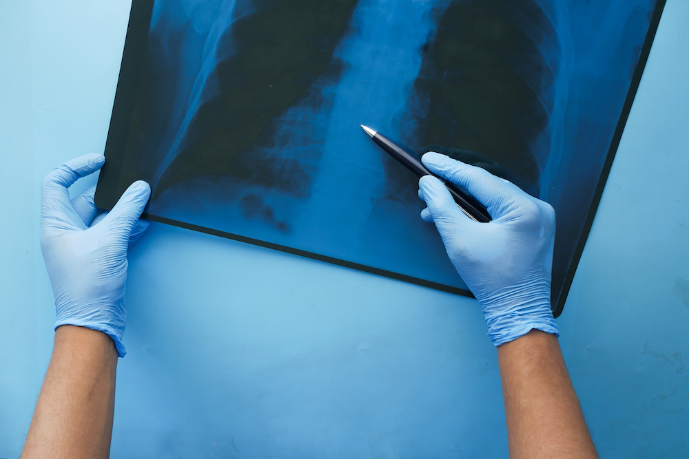 The Most Common Personal Injury Cases'