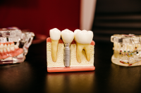Will Medicare Cover Dental Implants?