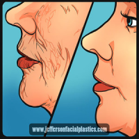 Jefferson Facial Plastics