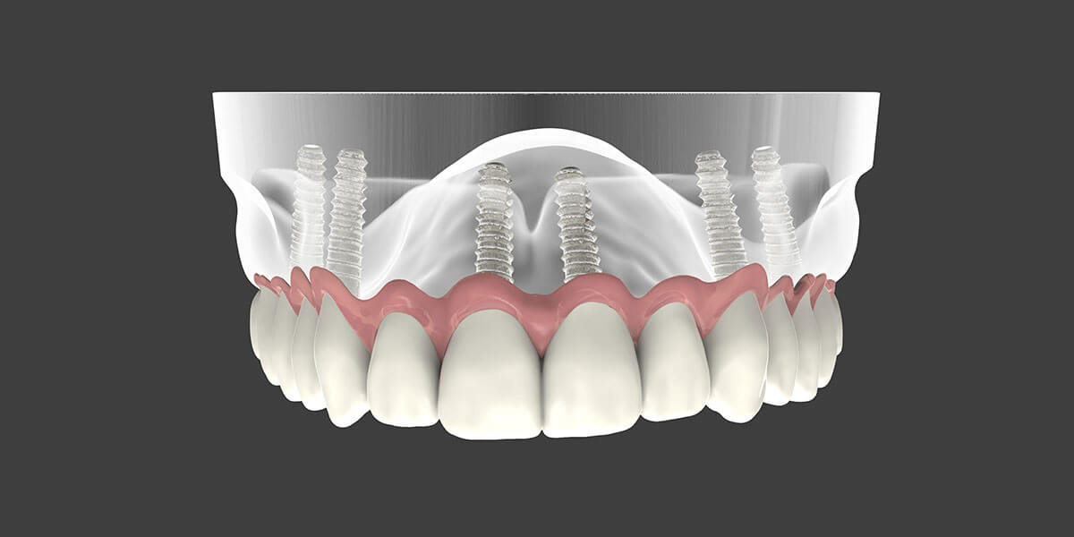 Company Logo For Champagne Smiles: Richard Champagne, DMD'