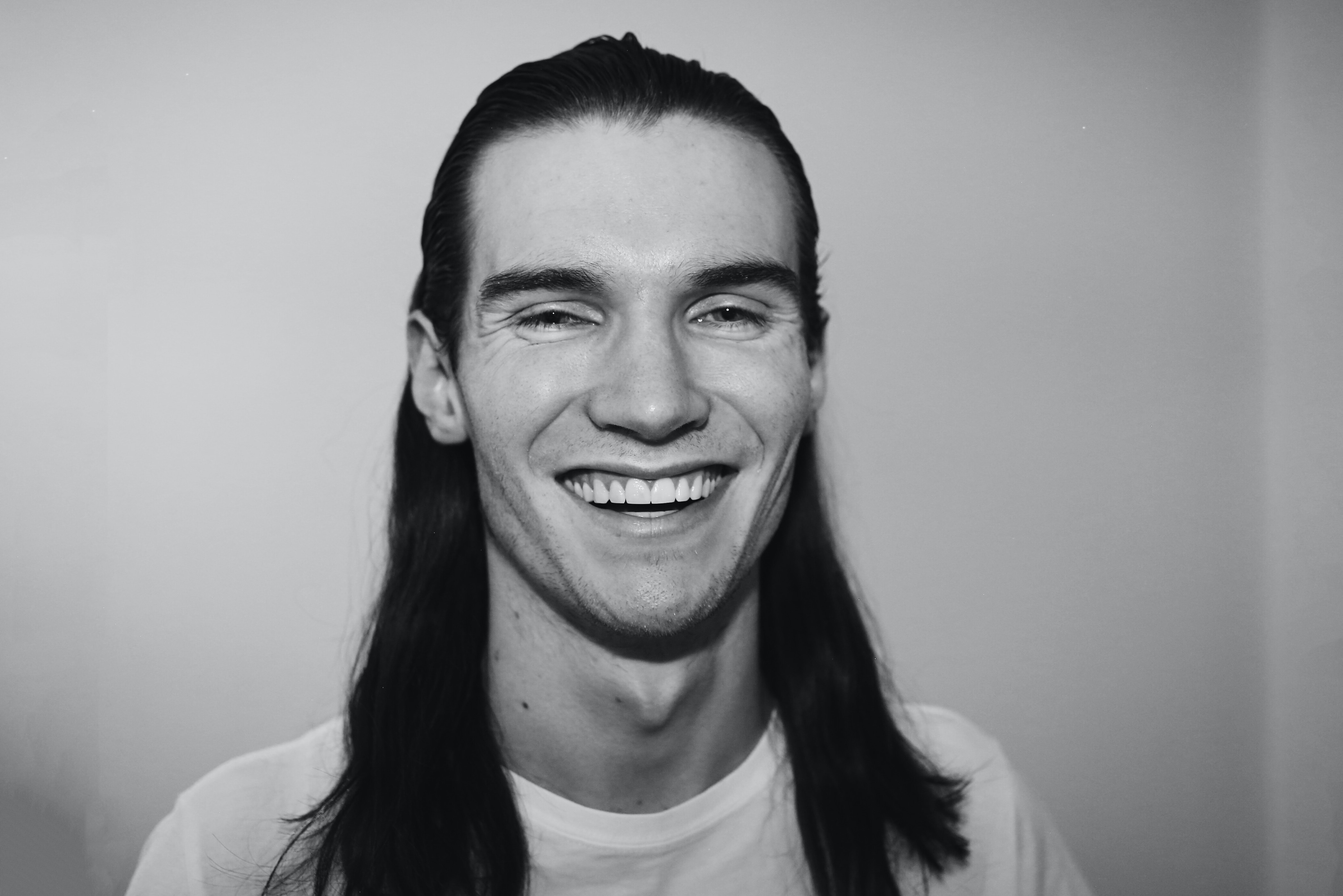 What to Know Before Getting Invisalign