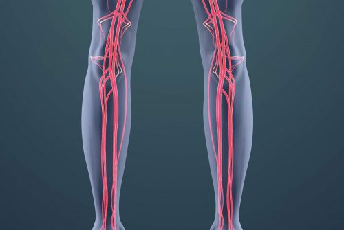 Vein Treatment Center in Loxahatchee'