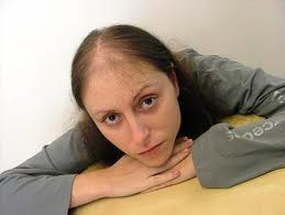 Provillus For Hair Loss'