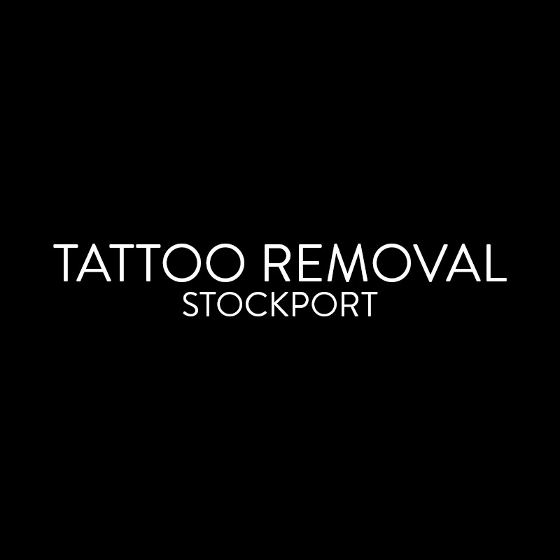 TATTOO REMOVAL STOCKPORT Logo