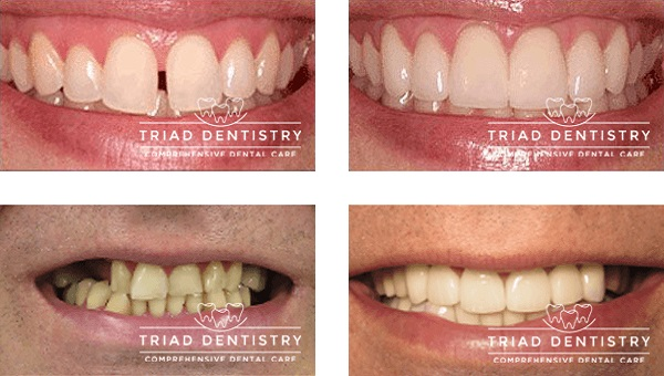 Company Logo For Triad Dentistry | Dental Implants Greensbor'