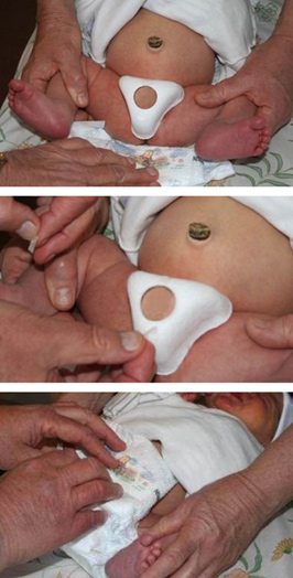 Innovative Medical Device'
