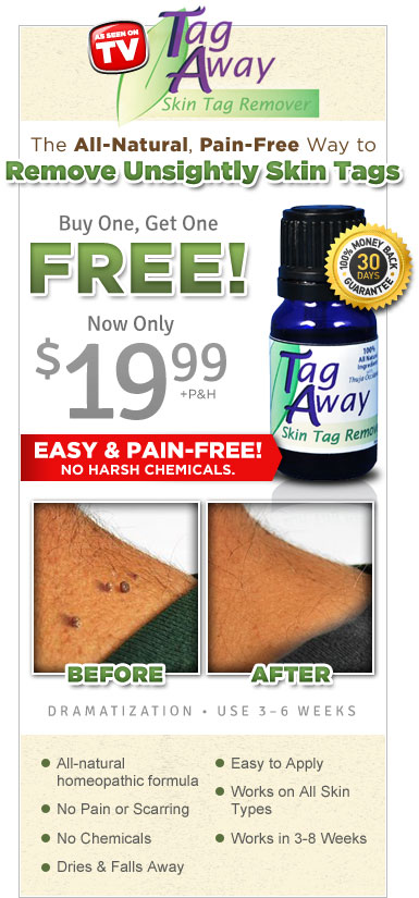 Tag Away Skin Tag Removal USA'