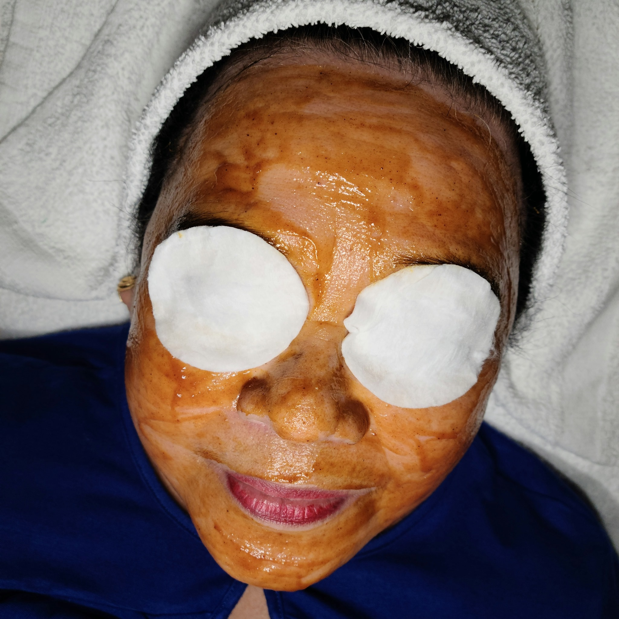 Trusculpting San Diego'