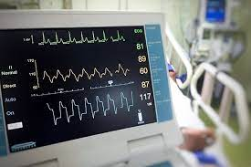 Cardiovascular Monitoring Devices (Cardiovascular Devices) M'