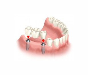 Company Logo For AZ Family Dental'