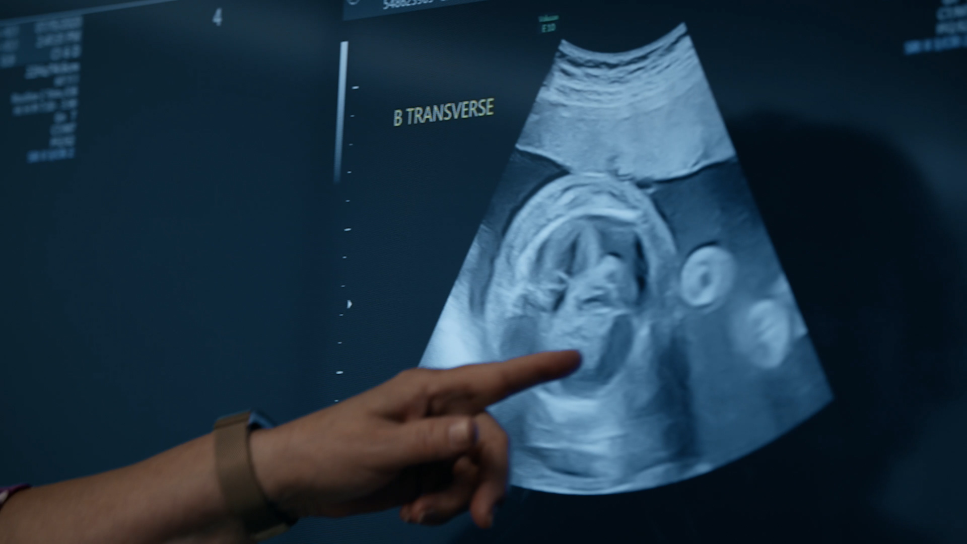 Intermountain Utah Fetal Center