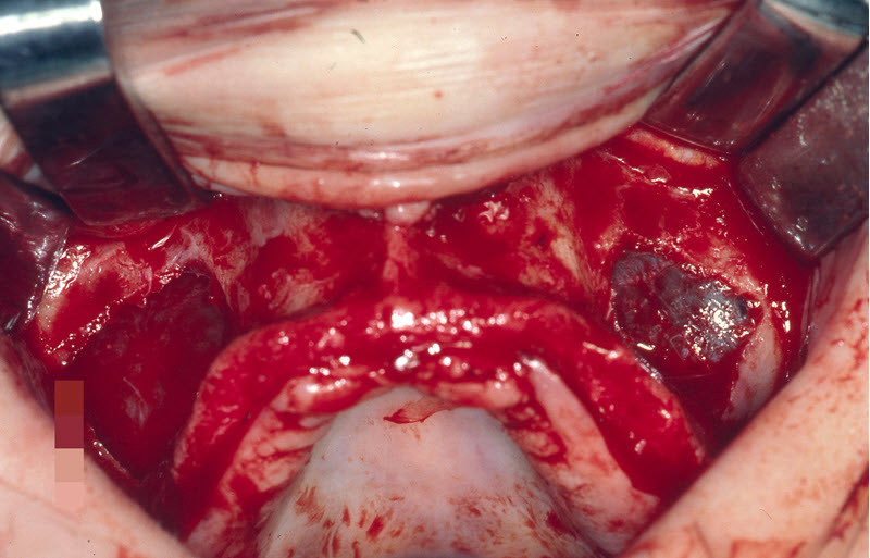 Oral and Maxillofacial Surgeon'