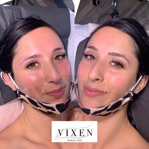 Company Logo For Vixen Esthetics ATX'