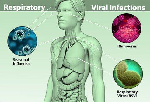 Respiratory Syncytial Virus Market