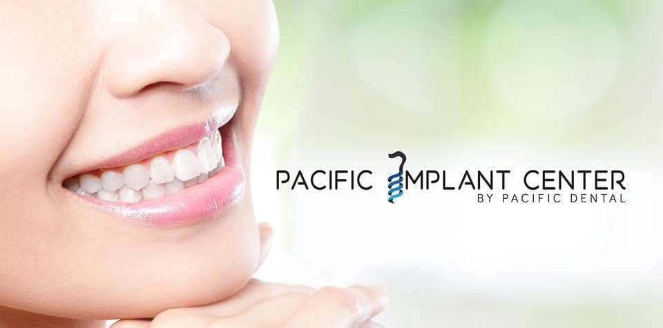 Company Logo For Pacific Implant Center'