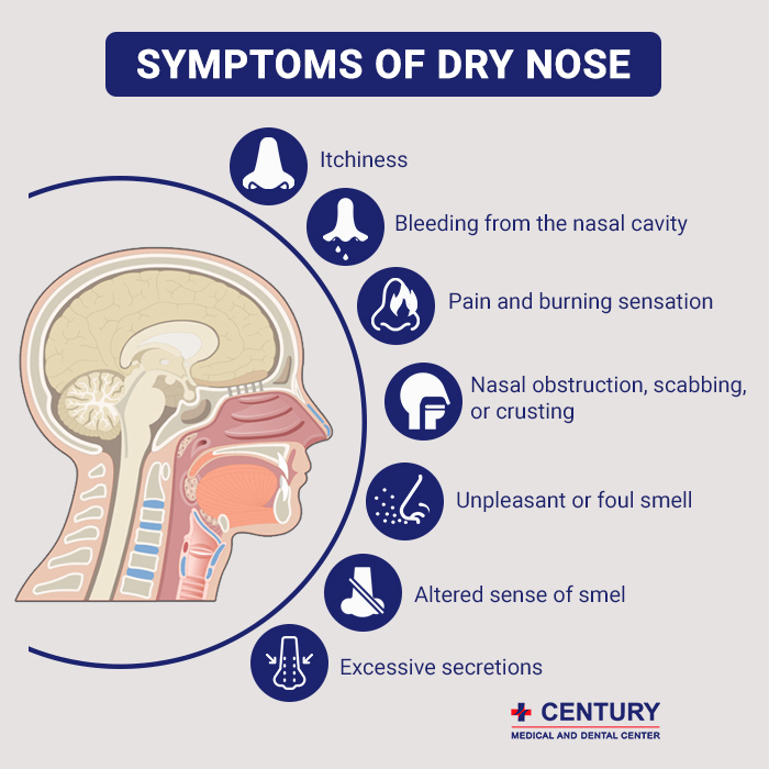 Symptoms of Dry Nose'