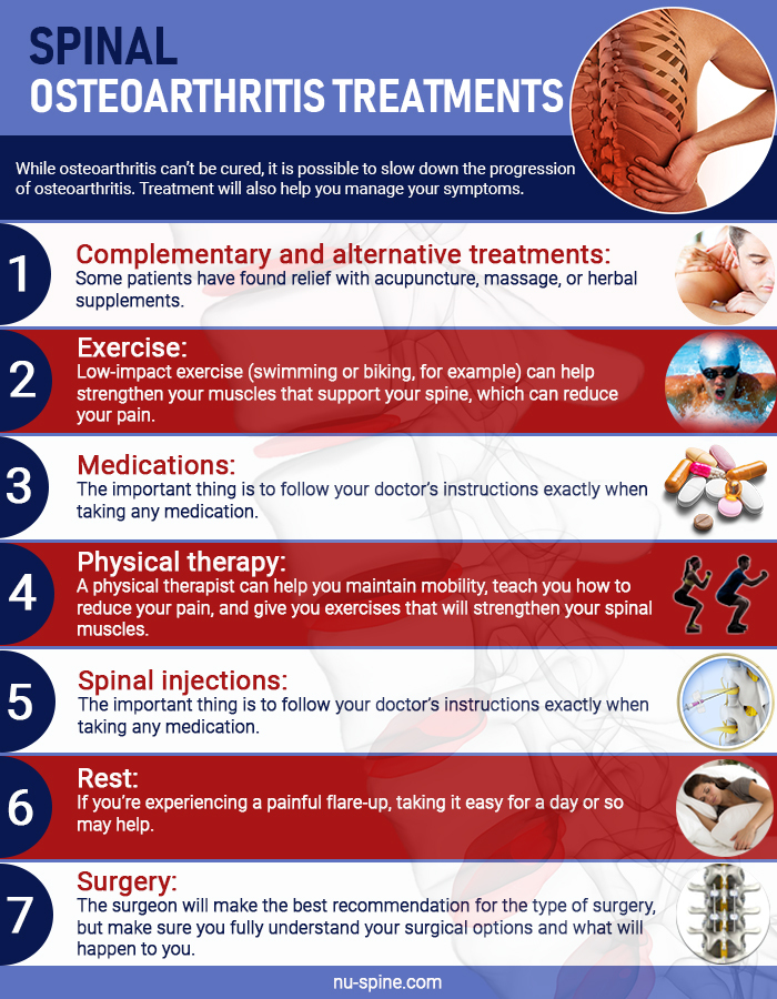 Spinal Osteoarthritis Treatments'