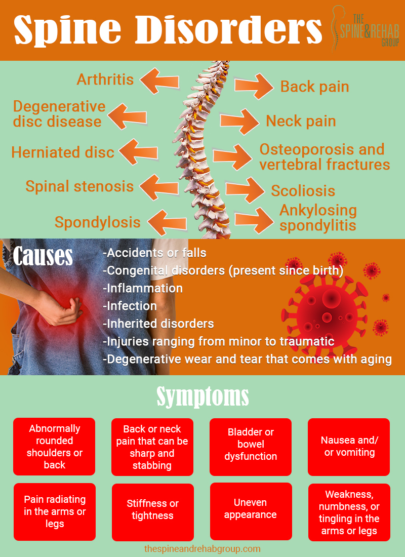 Spine Disorders'