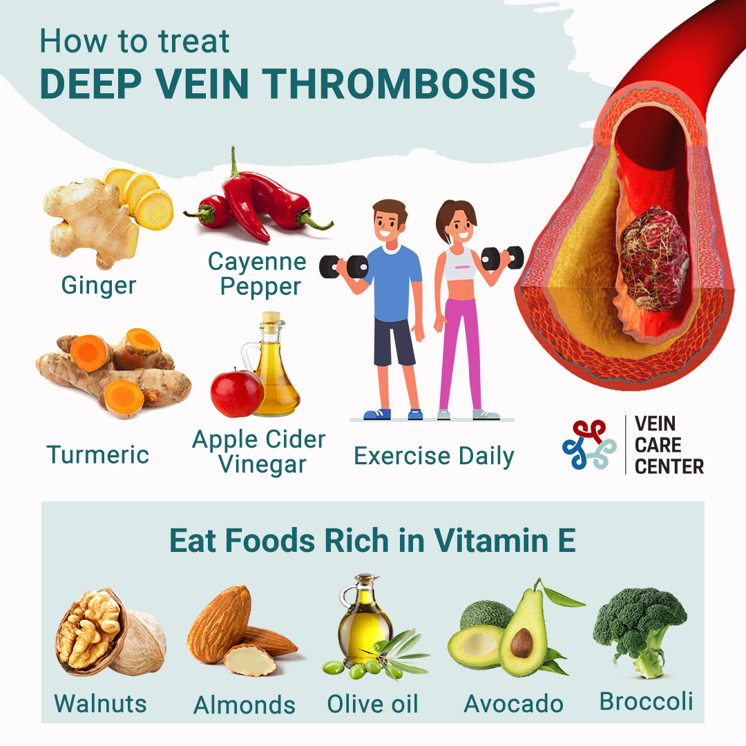 How to treat Deep Vein Thrombosis'