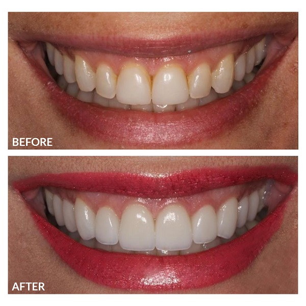 Company Logo For Total Care Dental'
