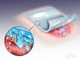 Advanced Wound Care Market'