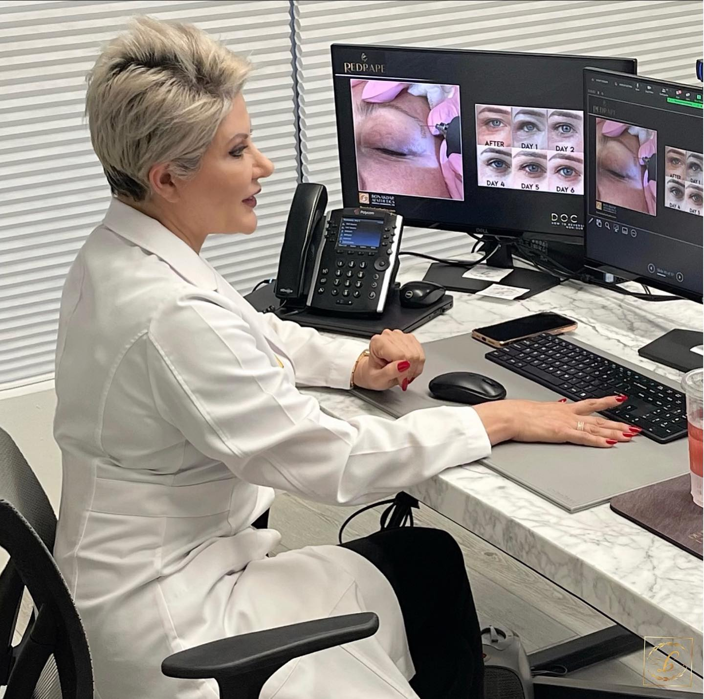 Microneedling Newport Beach'