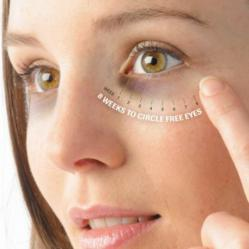 Under eye circles'