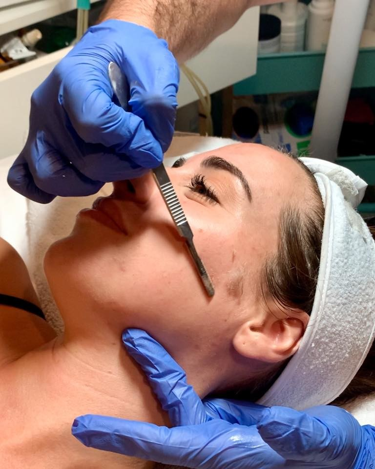 Chemical Peels'