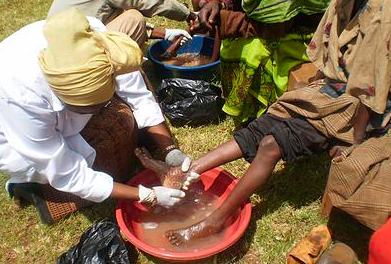 Survival of Kenya's Limbs'