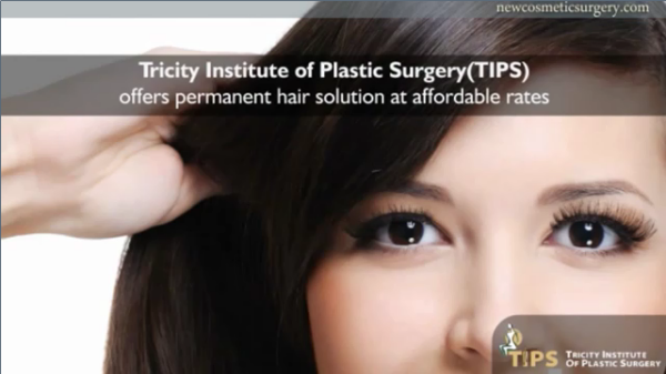 Hair Transplant in Chandigarh'