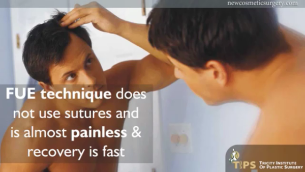 FUE Hair Transplant'