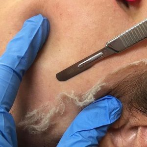Dermatologist'