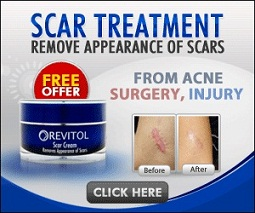 Scar Removal Cream'