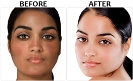 Revitol Skin Brightener Cream'