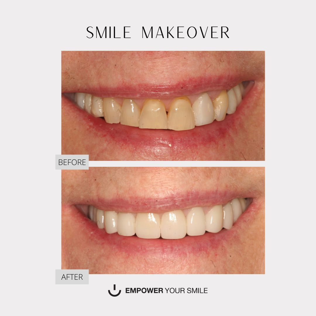 Company Logo For Empower Your Smile DDS'