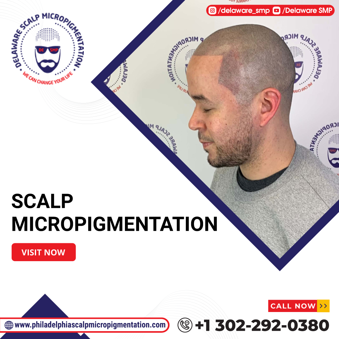 Scalp Micropigmentation'