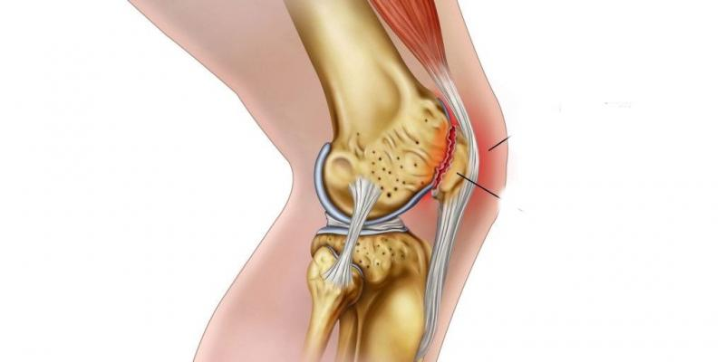 Below The Knee Stenosis Market'