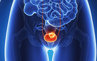 Bladder Cancer Therapeutics Market'