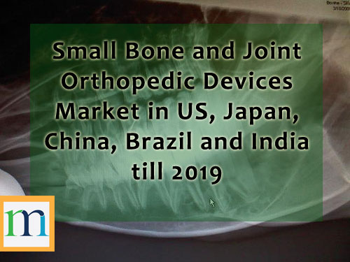 Small Bone & Joint Orthopedic Devices Market in 5 Countr'